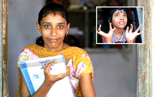 Endosulfan affected girl Shruthi  braves all odds ; to pursue medical course